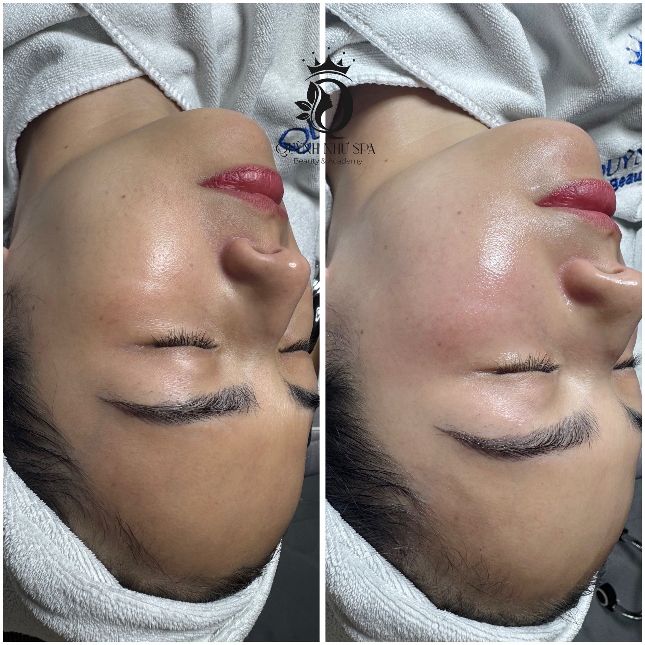 QUỲNH NHƯ Beauty Spa ảnh 2