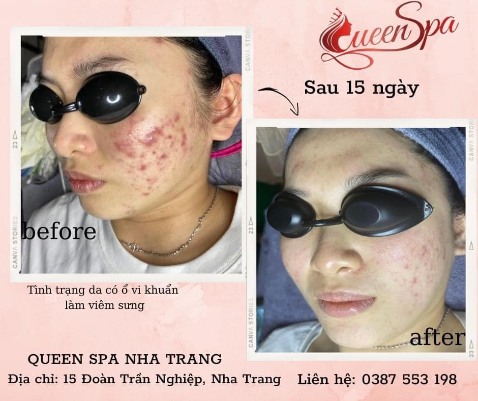 Queen Spa Nha Trang ảnh 2