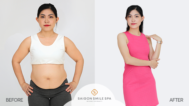 Saigon smile Spa ảnh 2