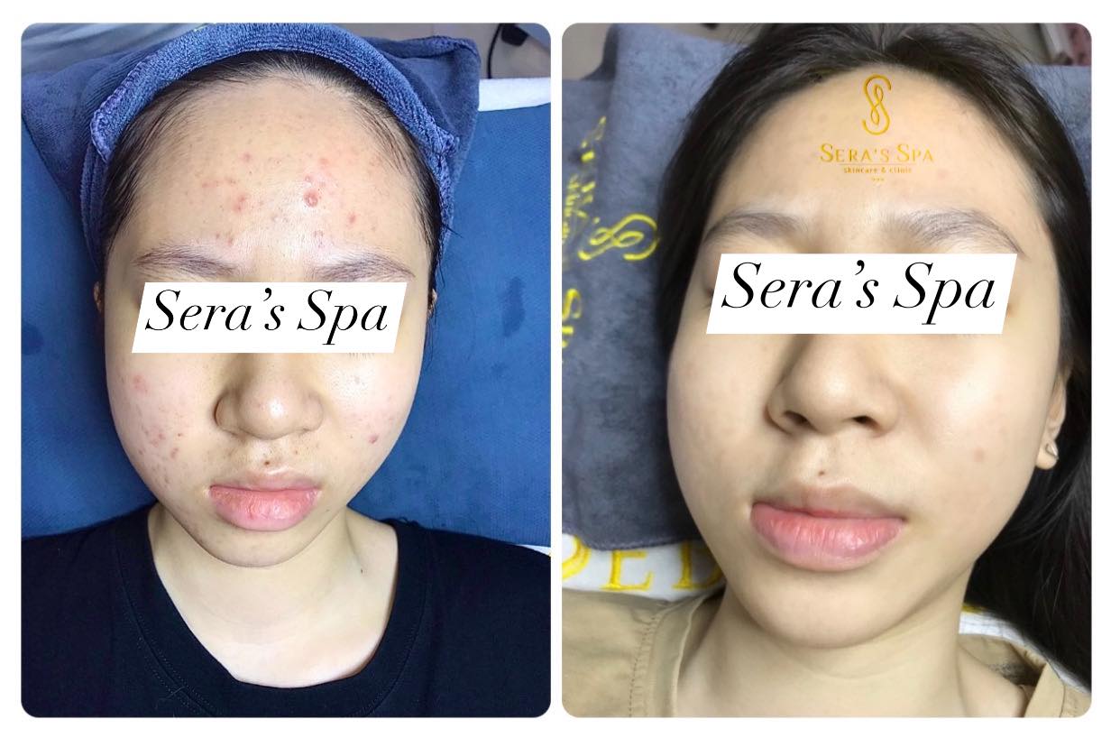 Sera’s Spa & Clinic ảnh 1