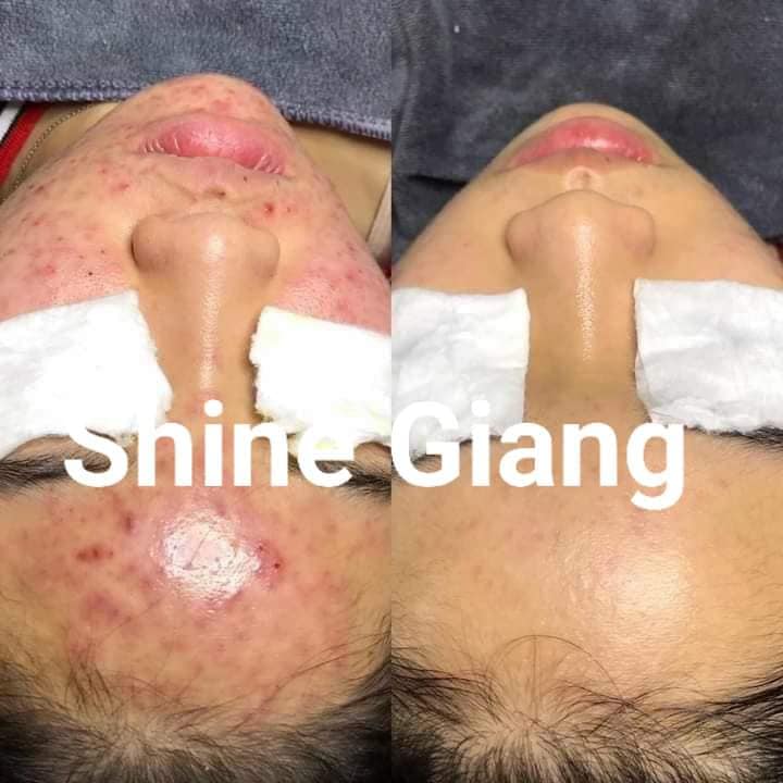 Shine Giang ảnh 1