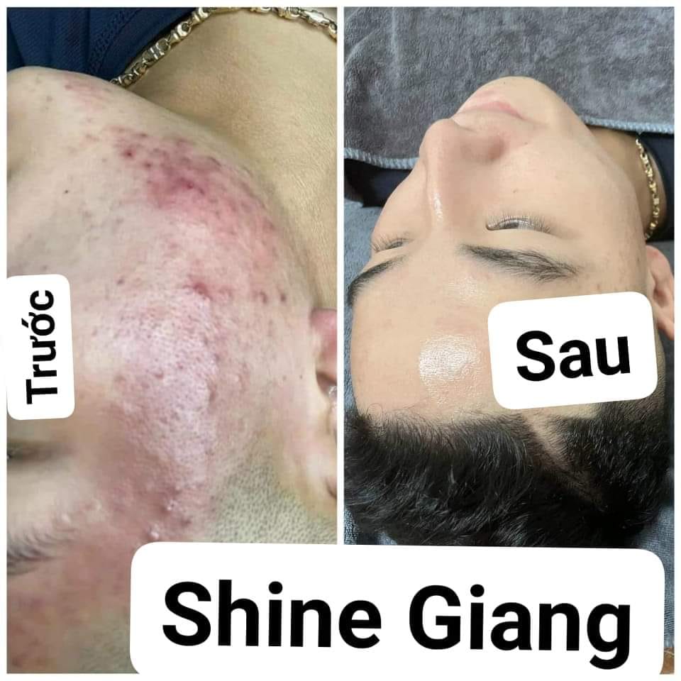 Shine Giang ảnh 2