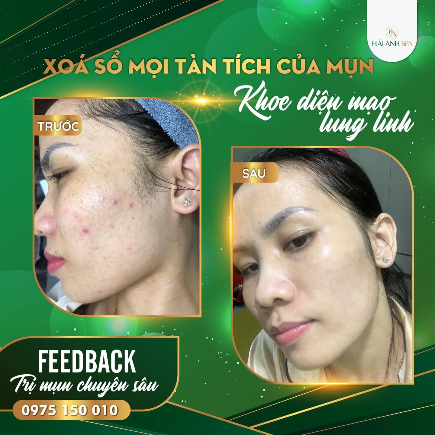 Spa Hải Anh ảnh 1