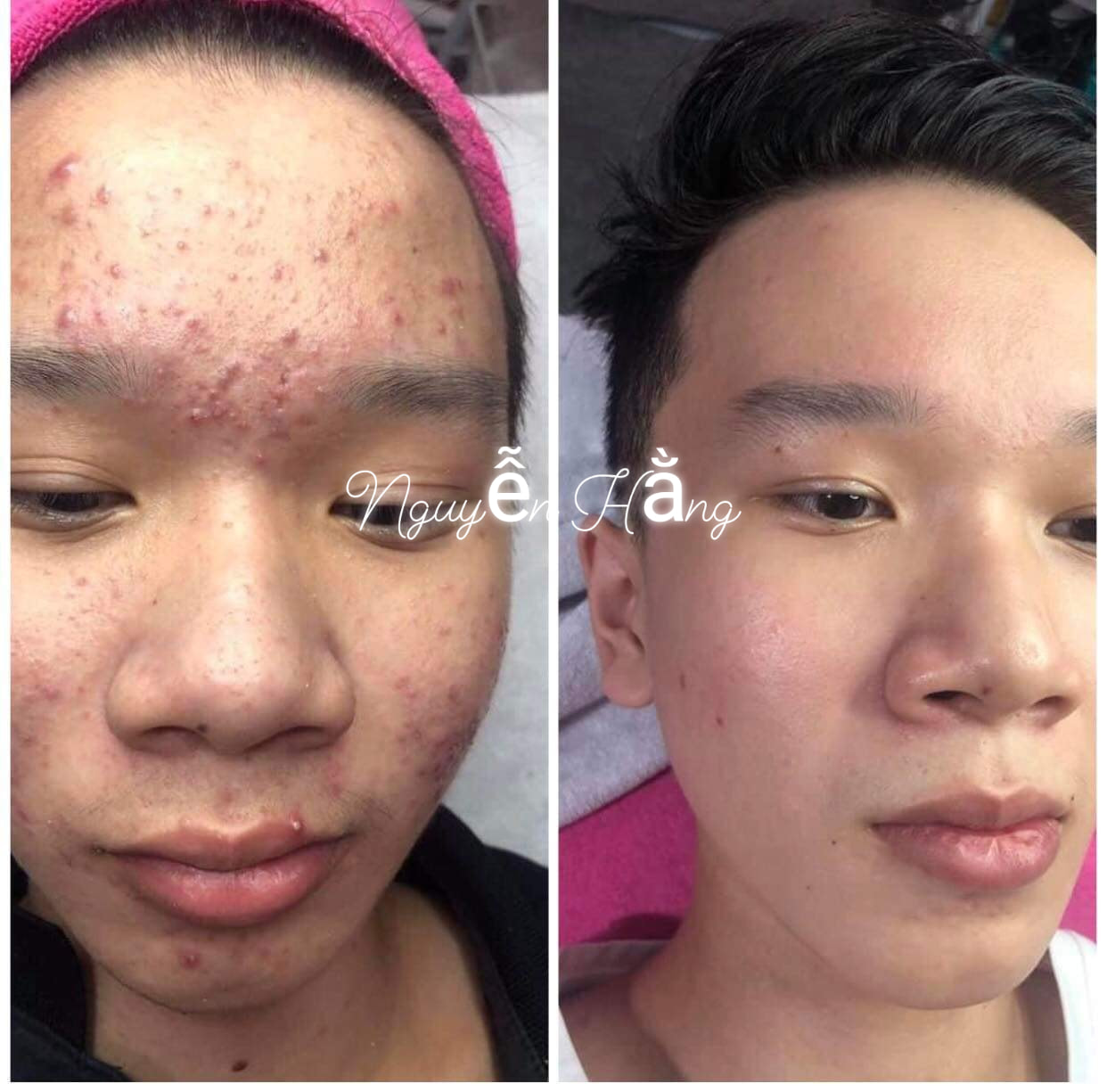 Spa Hồng Lam (Nguyễn Hằng) ảnh 1