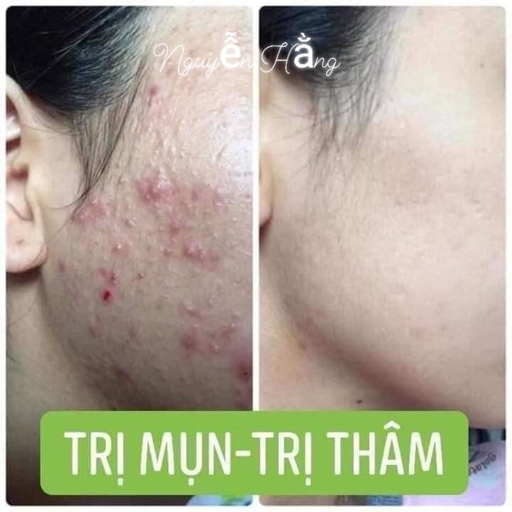 Spa Hồng Lam (Nguyễn Hằng) ảnh 2