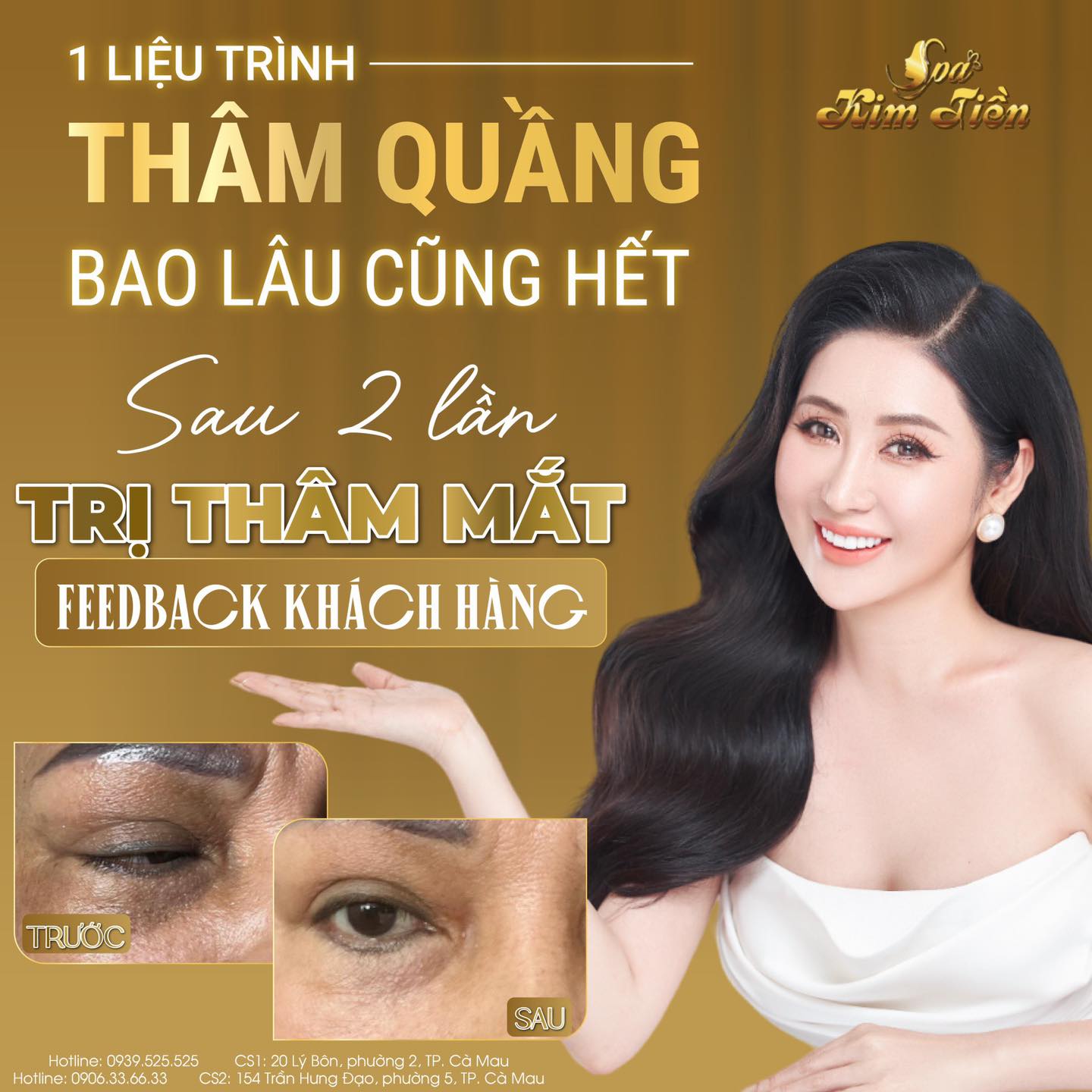 Spa Kim Tiền ảnh 2