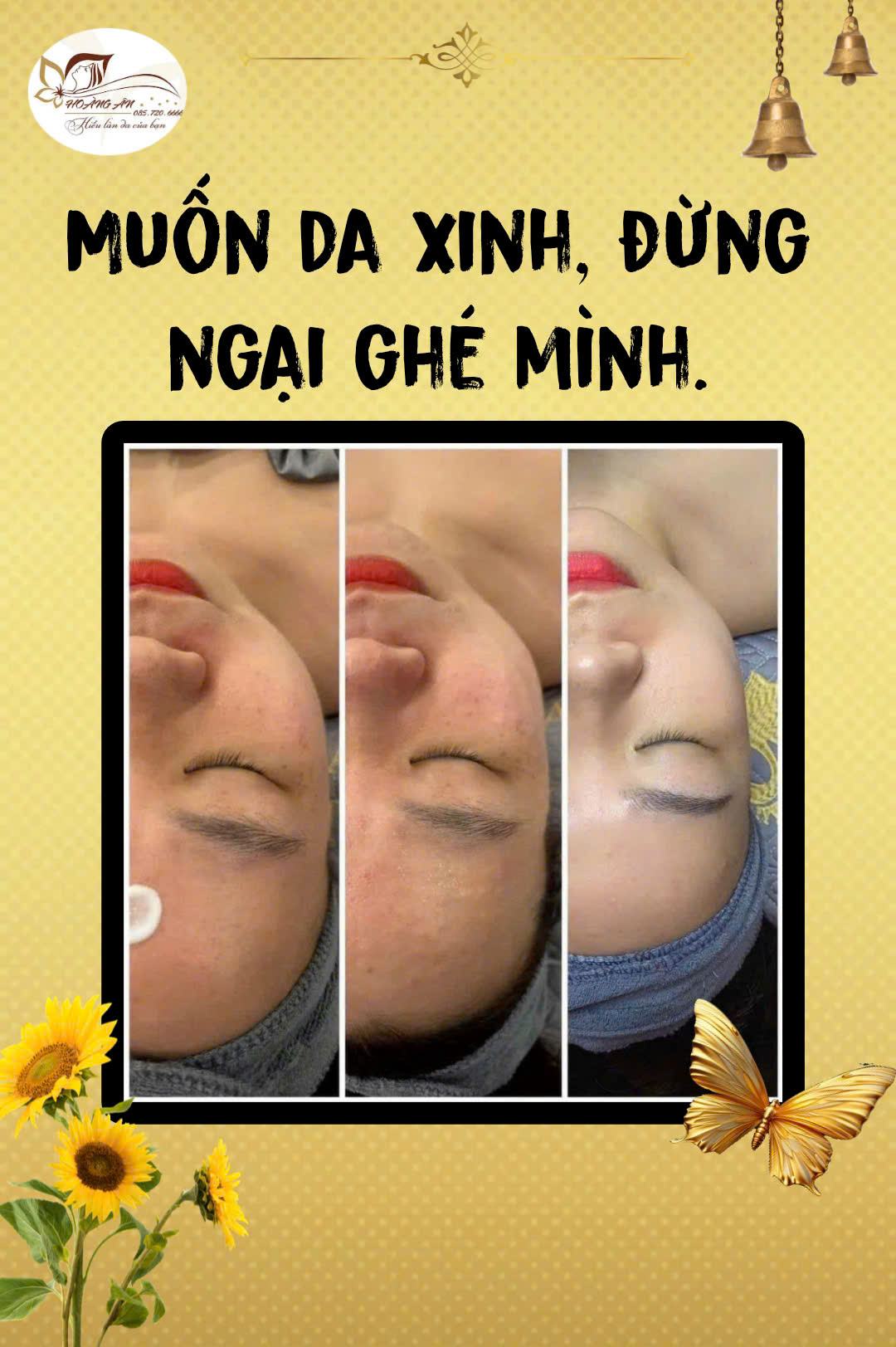 Thẩm Mỹ Hoàng Ân Lào Cai ảnh 1