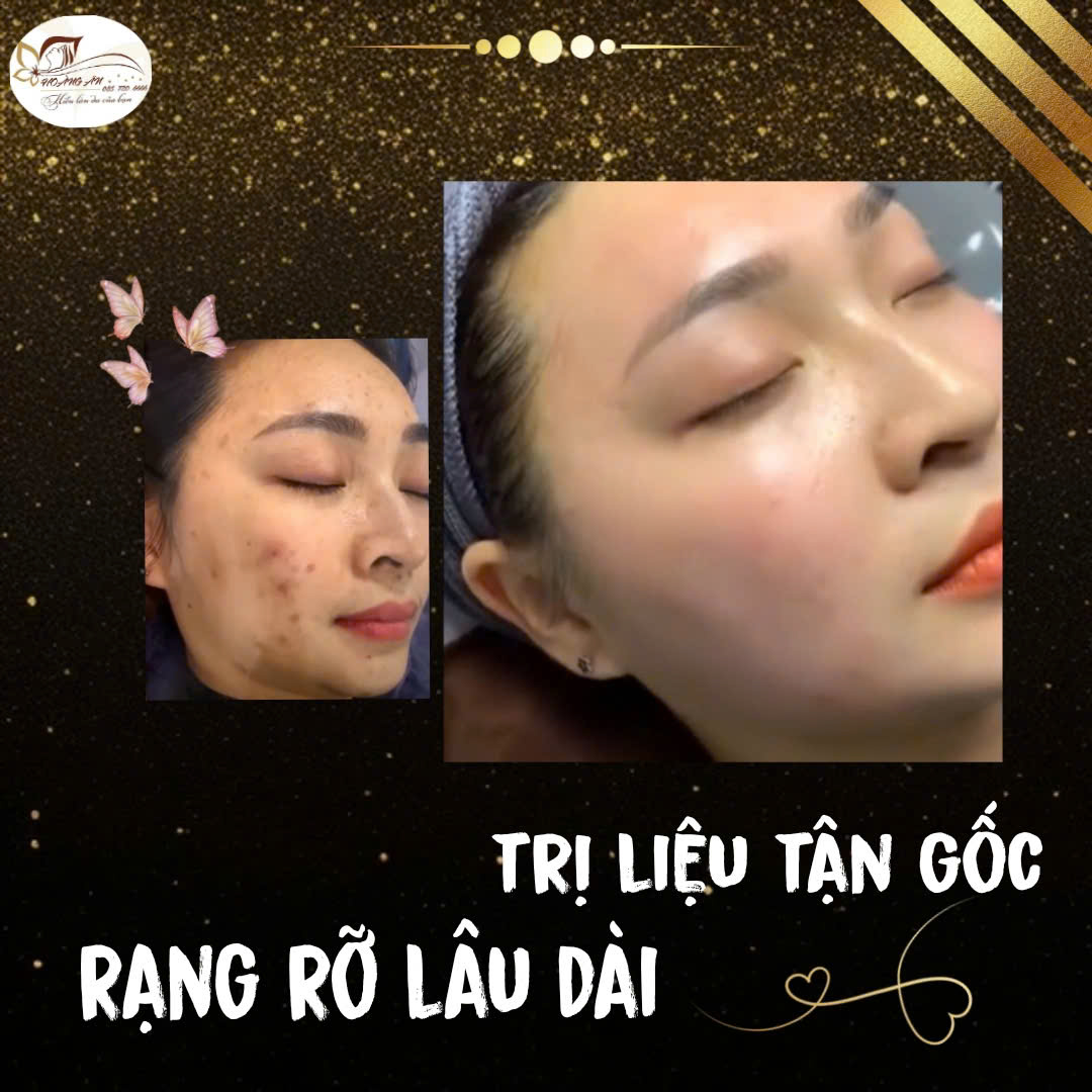 Thẩm Mỹ Hoàng Ân Lào Cai ảnh 2