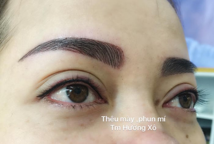 Thẩm Mỹ Hường Xô ảnh 2