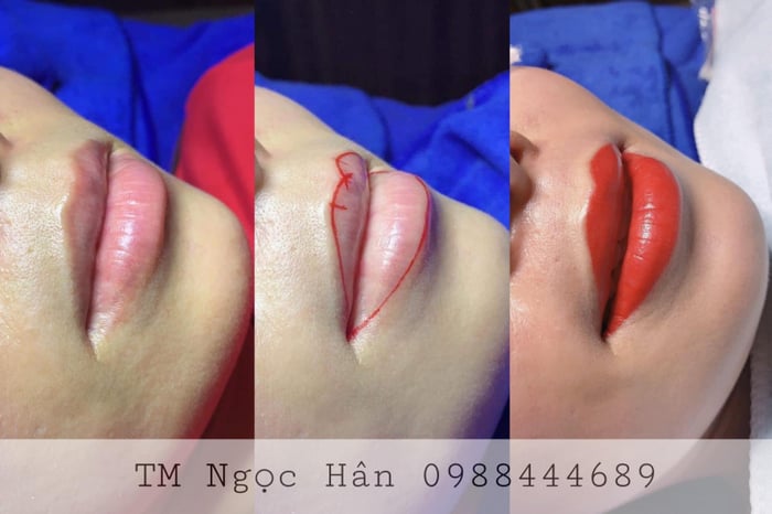 Thẩm Mỹ Ngọc Hân TiKi beauty ảnh 2