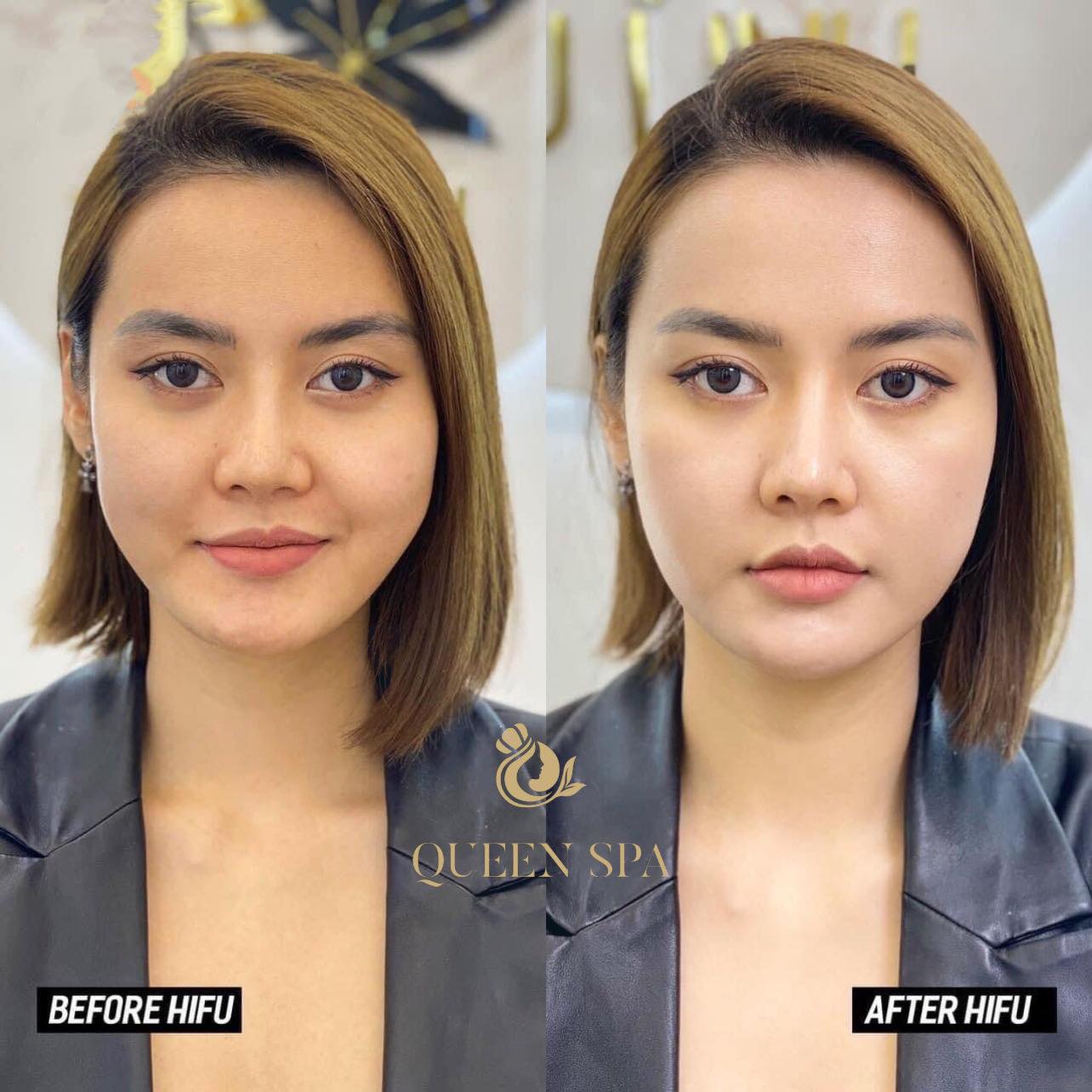 Thẩm Mỹ Queen Spa ảnh 1