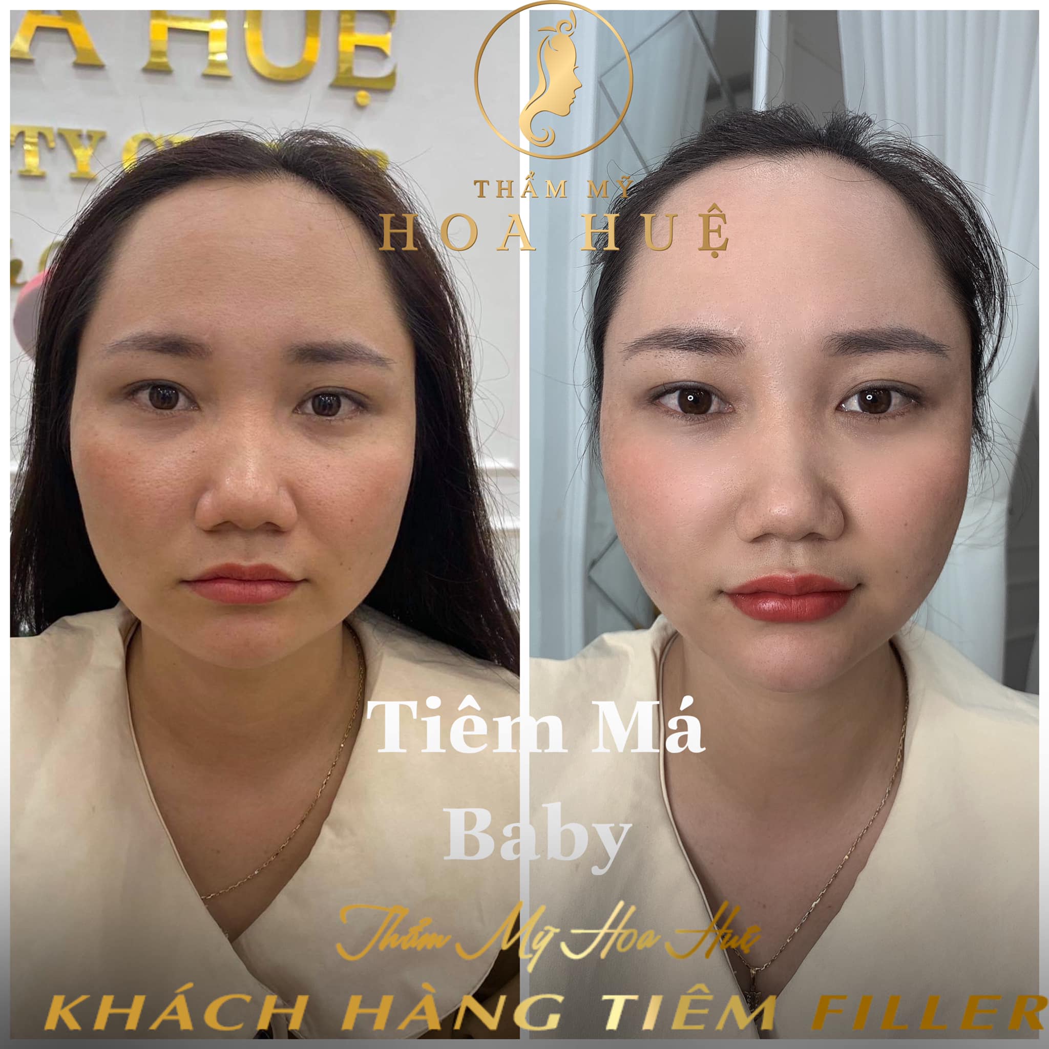 Thẩm Mỹ Quốc Tế Hoa Huệ ảnh 2