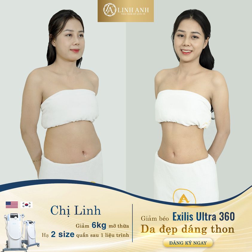 Thẩm Mỹ Quốc Tế Linh Anh ảnh 1