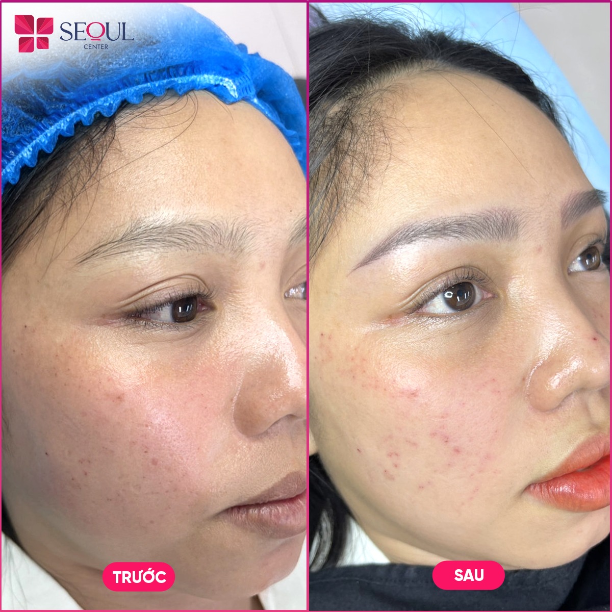Thẩm Mỹ Seoul Center Bến Tre ảnh 2
