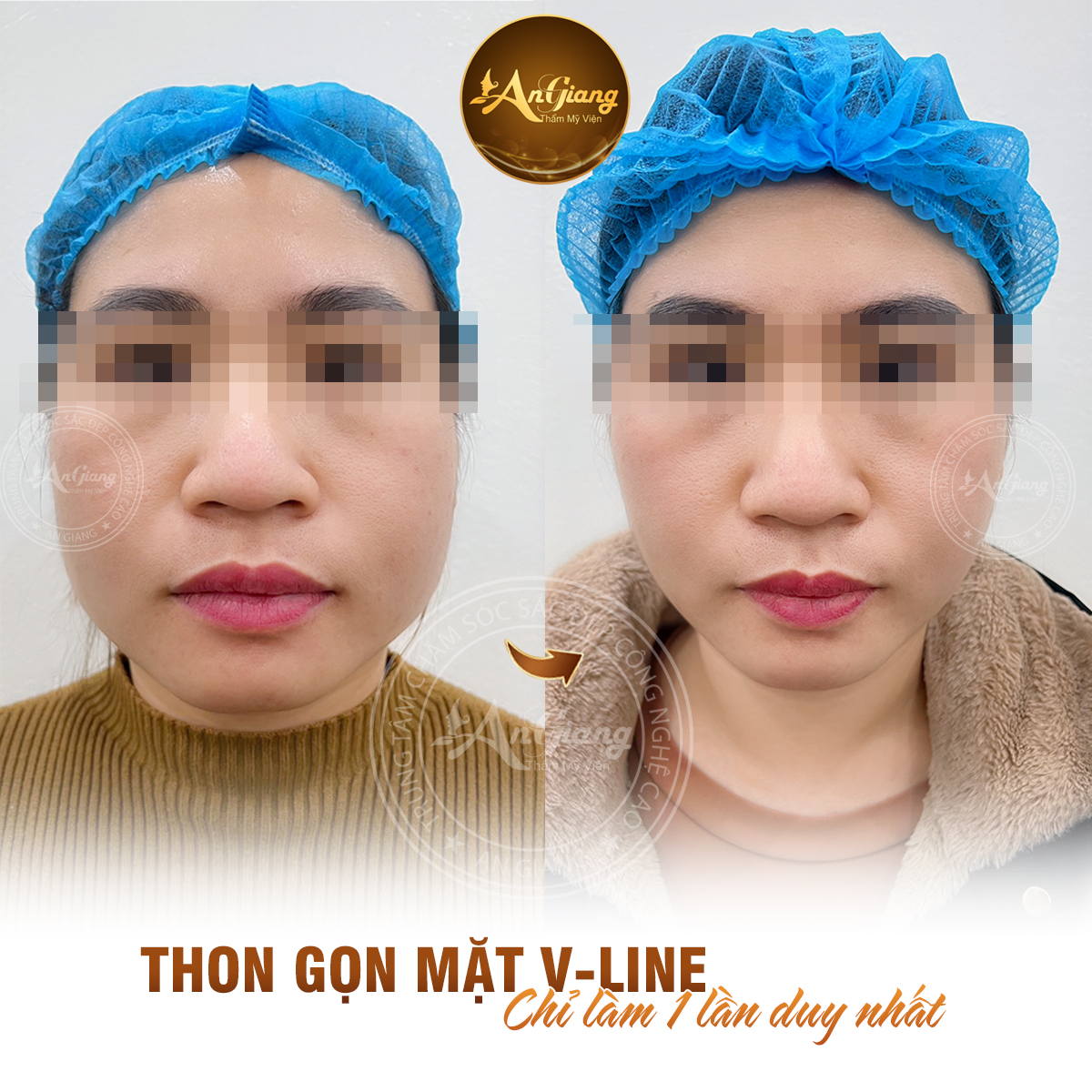 Thẩm Mỹ Viện AN GIANG ảnh 1