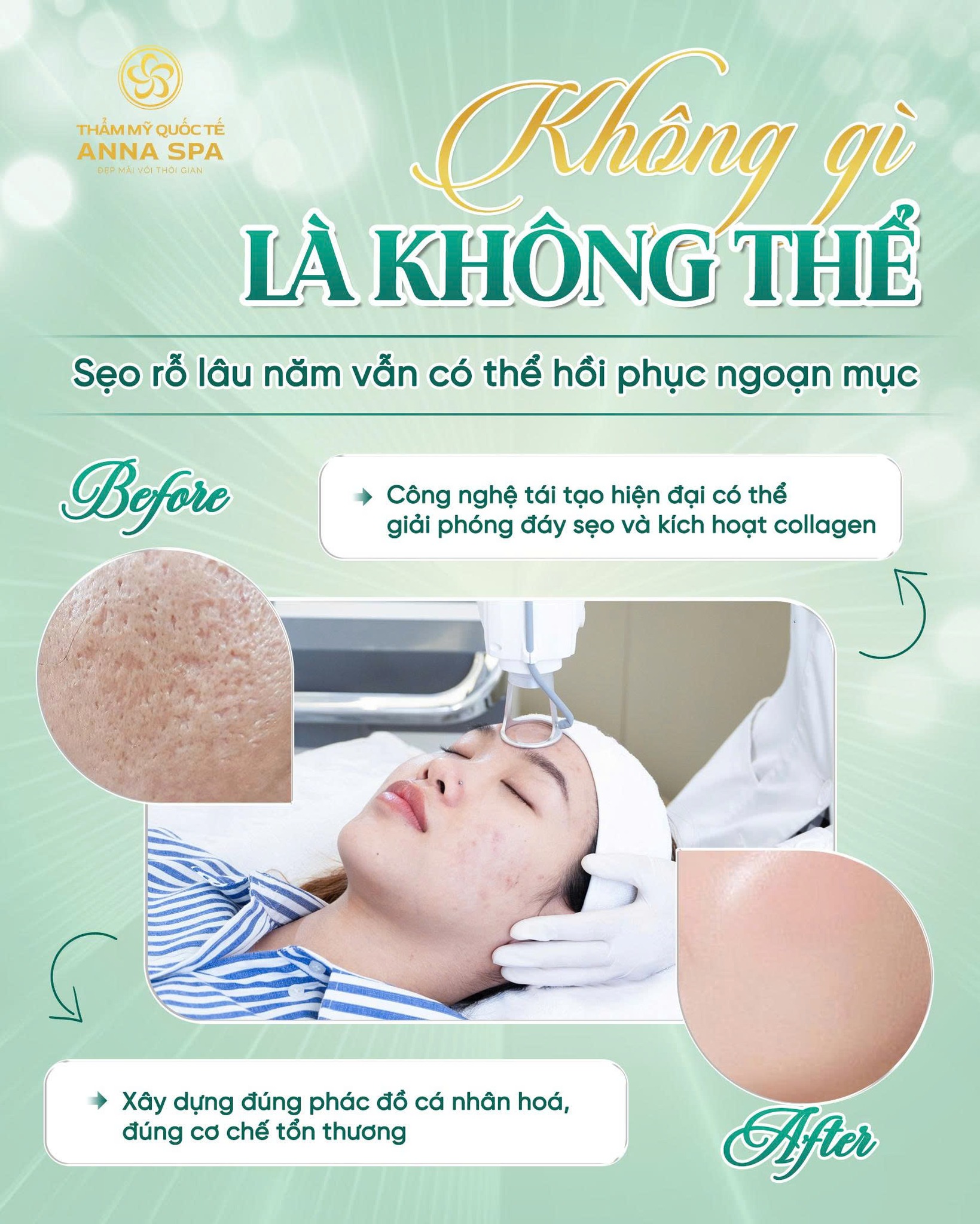 Thẩm Mỹ Viện Anna Spa ảnh 1