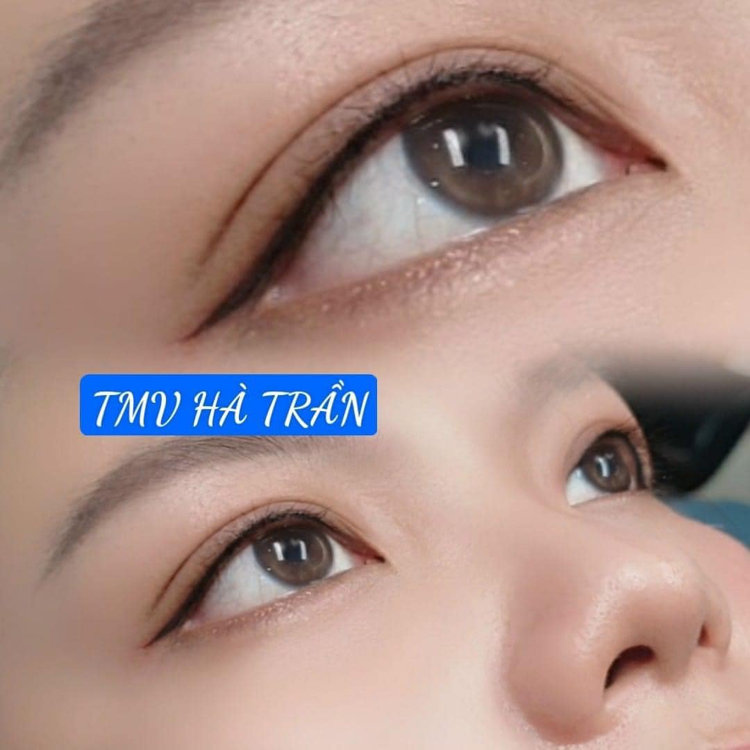 Thẩm Mỹ Viện Hà Trần ảnh 2