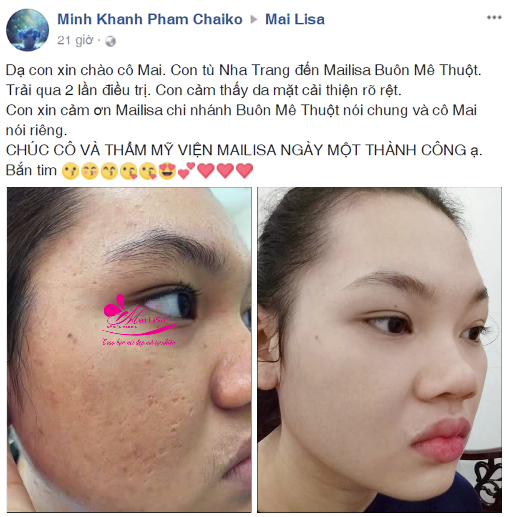 Thẩm Mỹ Viện Mailisa ảnh 2