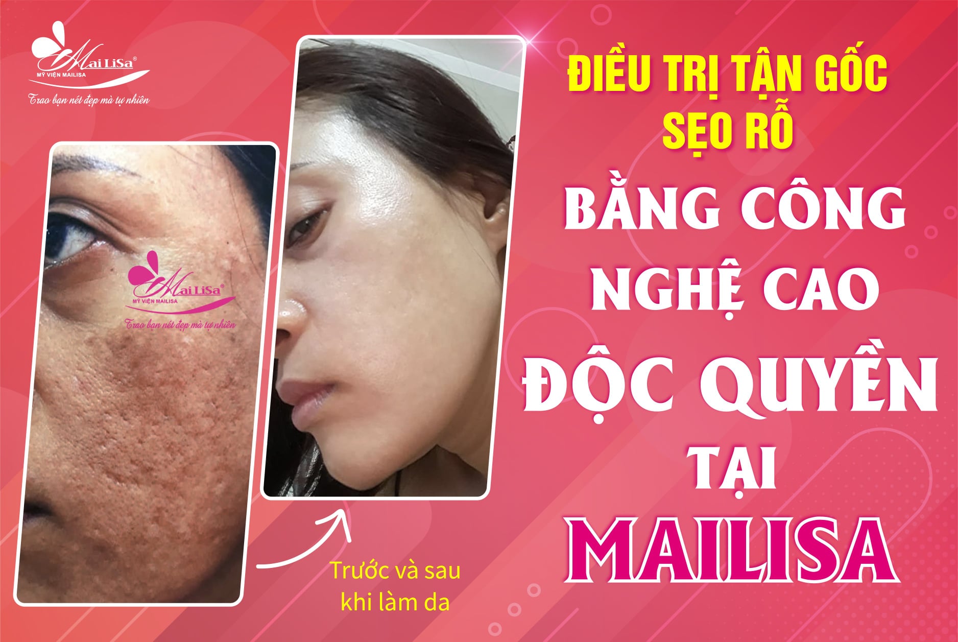 Thẩm Mỹ Viện Mailisa ảnh 2