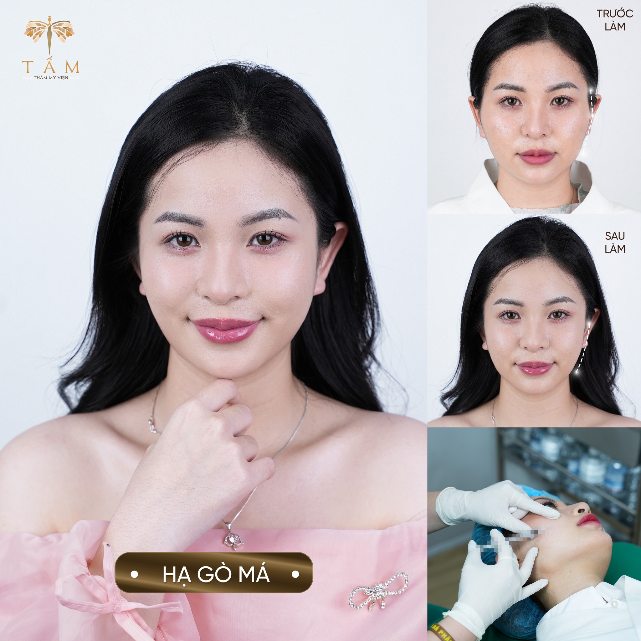 Thẩm Mỹ Viện Tấm ảnh 2