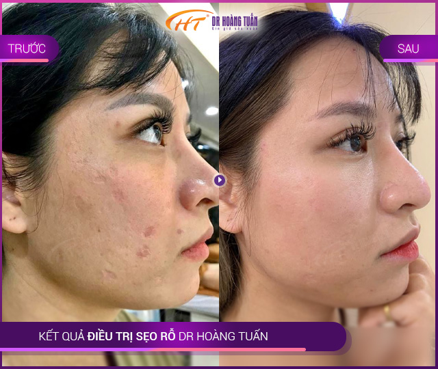 Thẩm mỹ Dr. Hoàng Tuấn ảnh 2