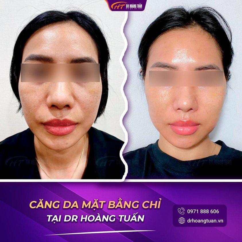 Thẩm mỹ Hoàng Tuấn ảnh 2