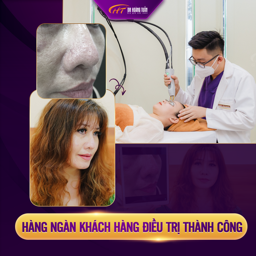 Thẩm mỹ Hoàng Tuấn ảnh 1