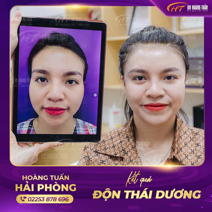 Thẩm mỹ Hoàng Tuấn - Hải Phòng ảnh 1