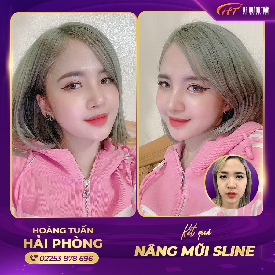 Thẩm mỹ Hoàng Tuấn - Hải Phòng ảnh 2