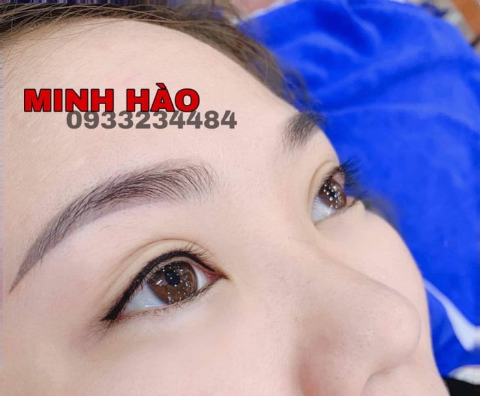 Thẩm mỹ Minh Hào ảnh 2