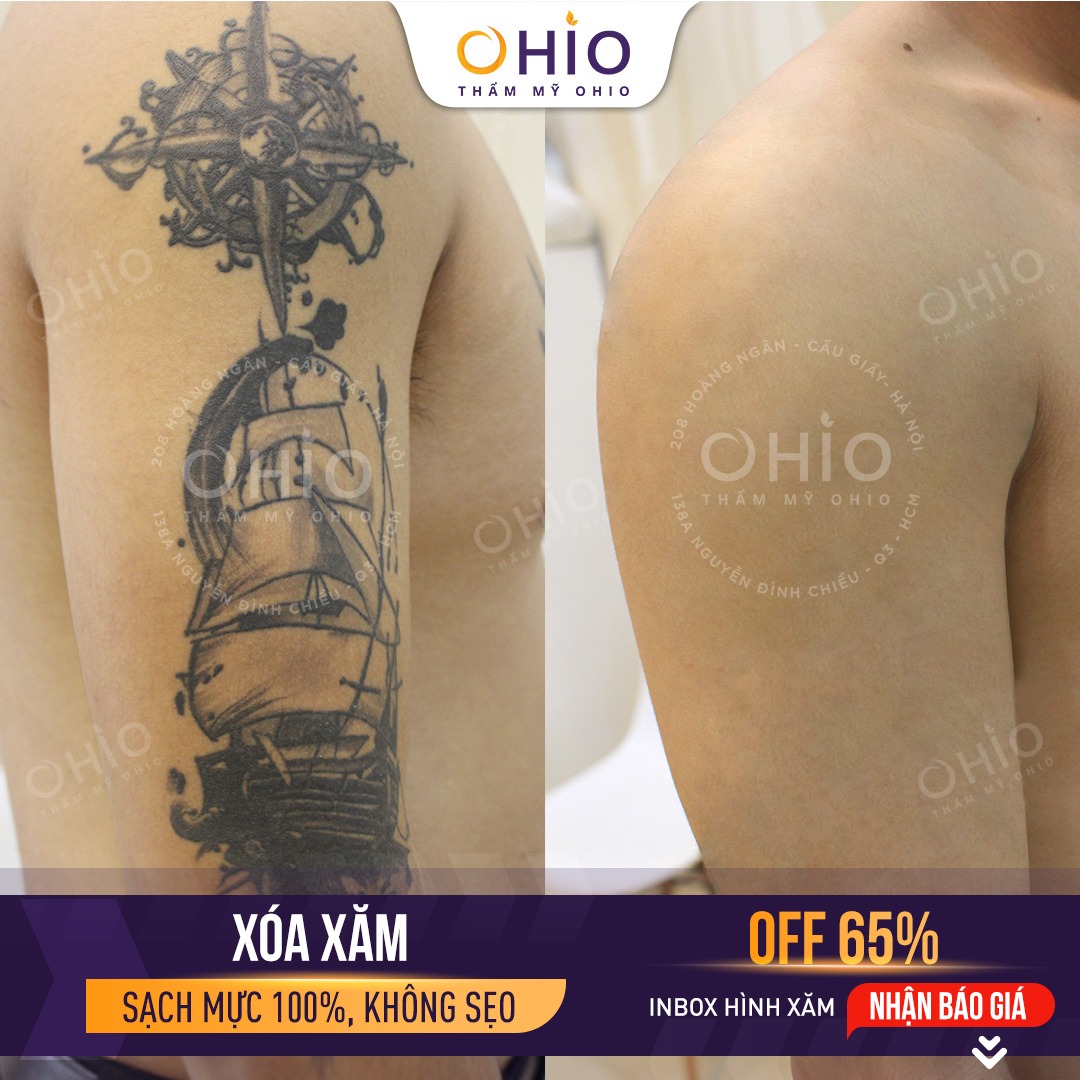 Thẩm mỹ OHIO ảnh 2