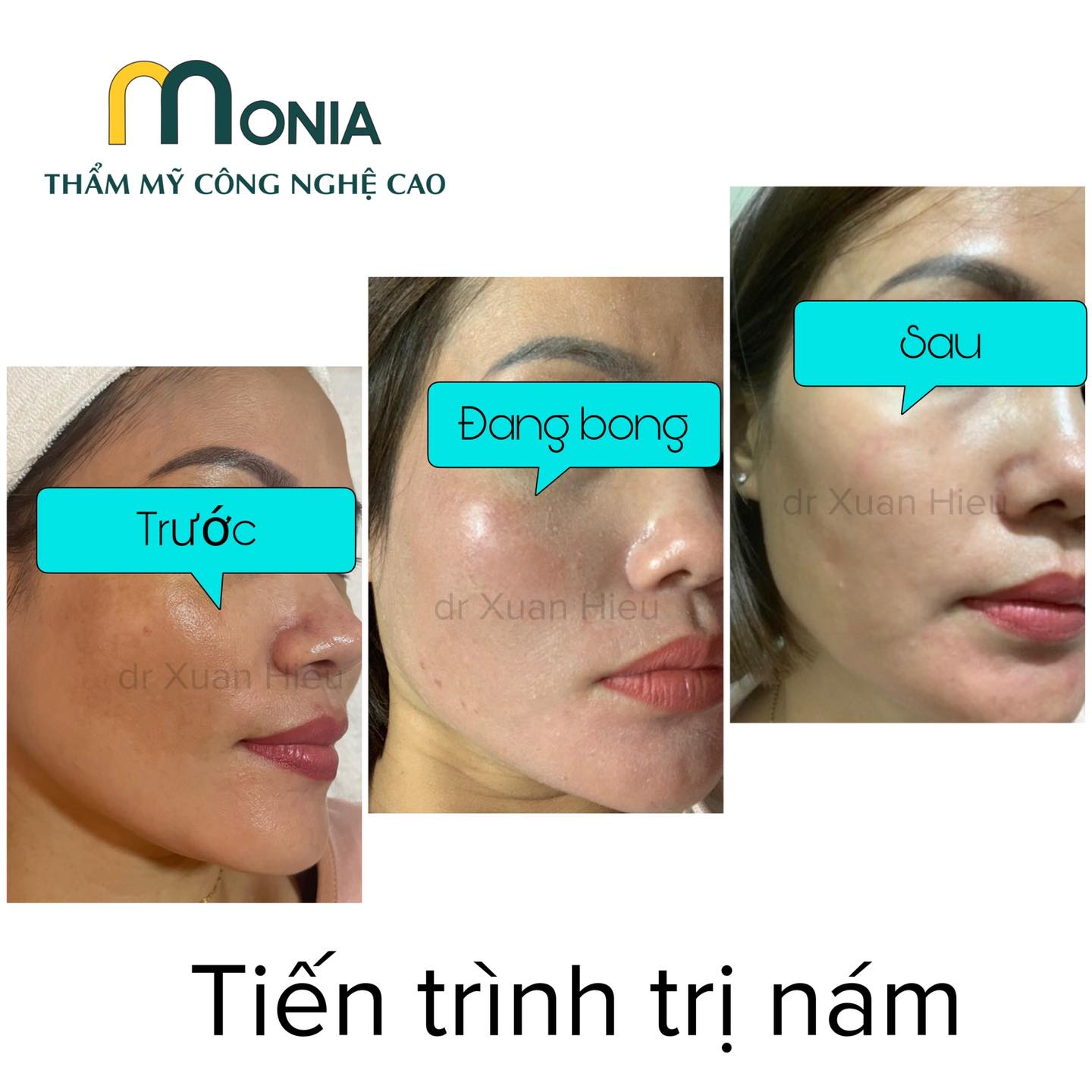 Thẩm mỹ công nghệ cao Monia ảnh 1