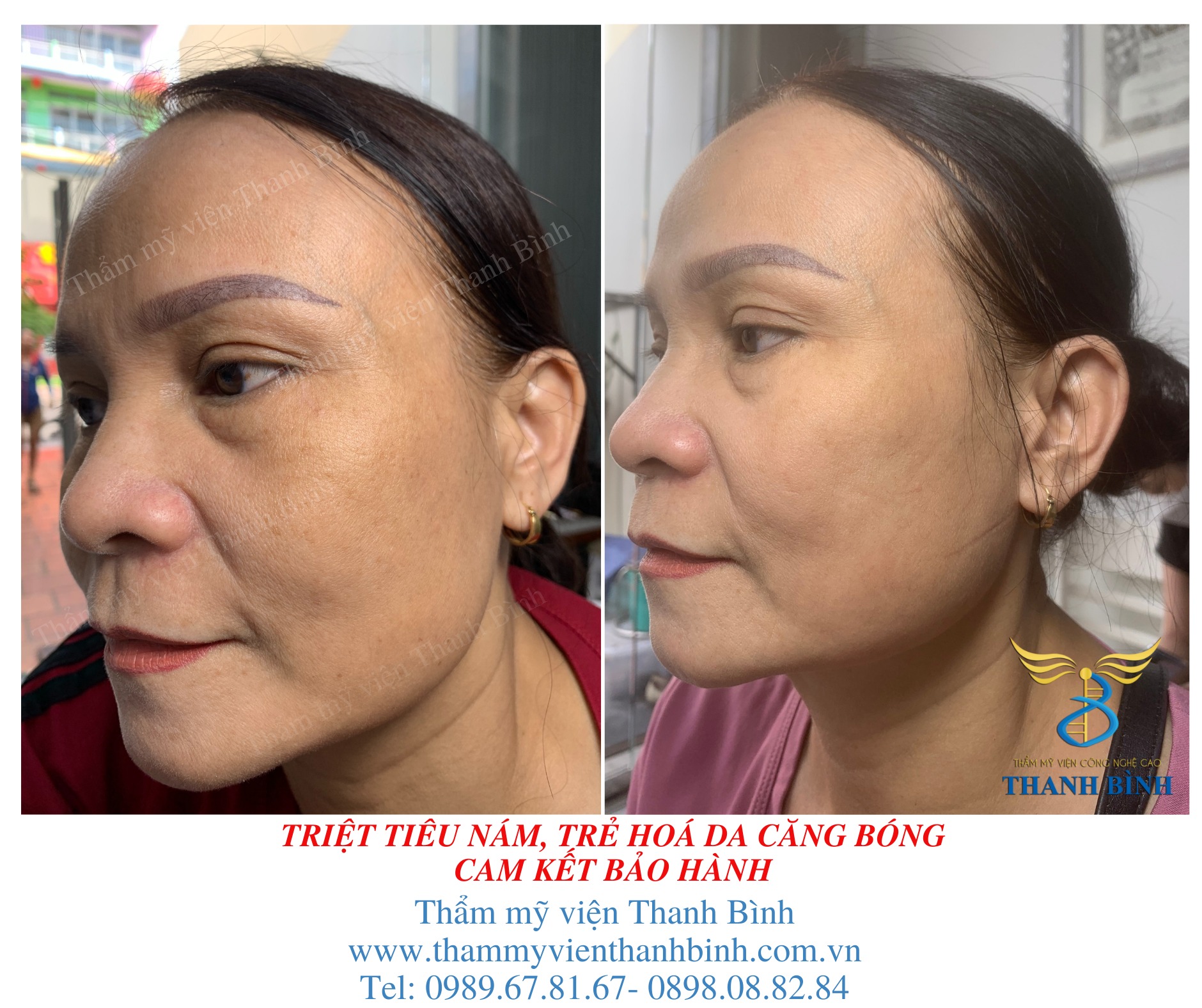 Thẩm mỹ viện Thanh Bình ảnh 2