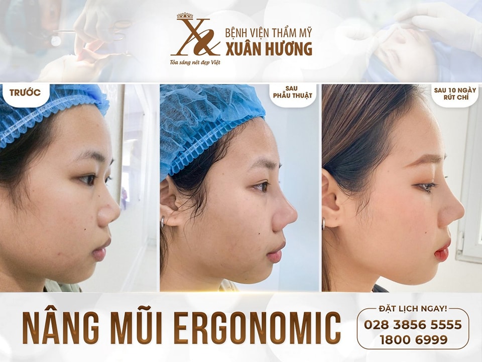 Thẩm mỹ viện Xuân Hương ảnh 2