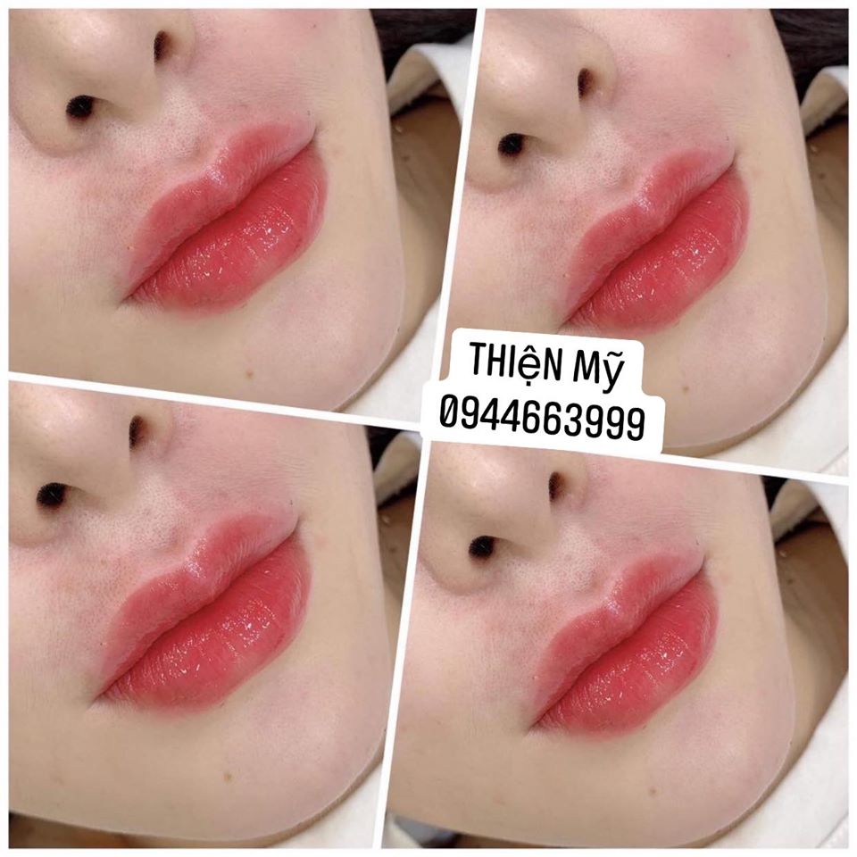 Thiện Mỹ Beauty Spa ảnh 1