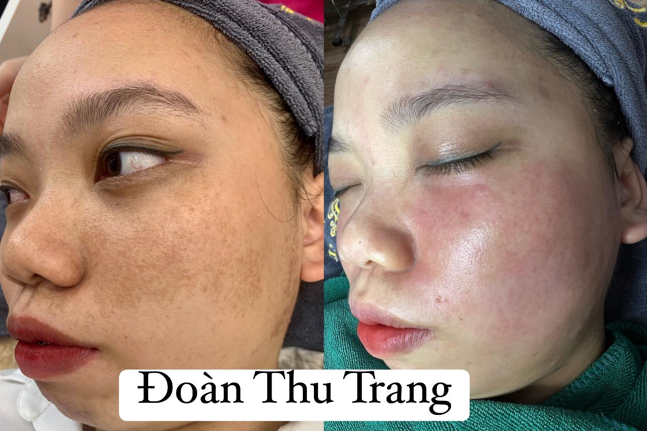 Trang Beauty Spa & Clinic ảnh 1