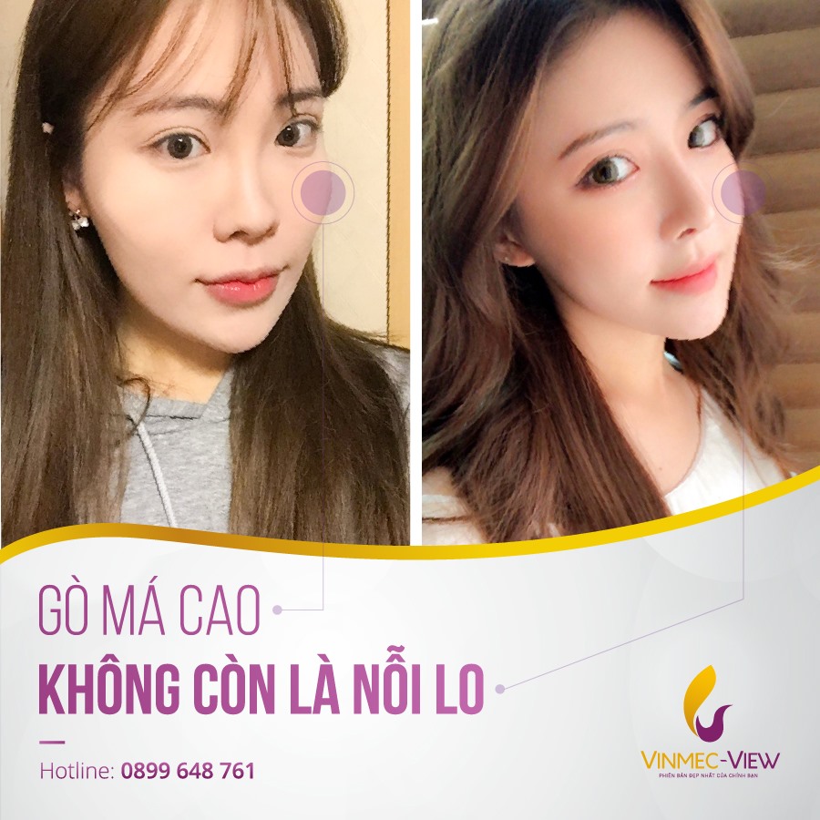 Trung tâm Thẩm mỹ Vinmec-View ảnh 2