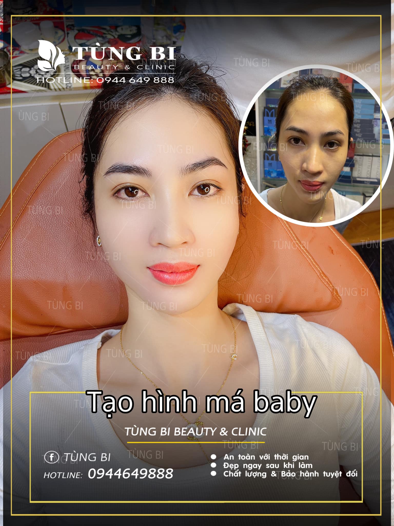 Tùng Bi Beauty & Clinic ảnh 1