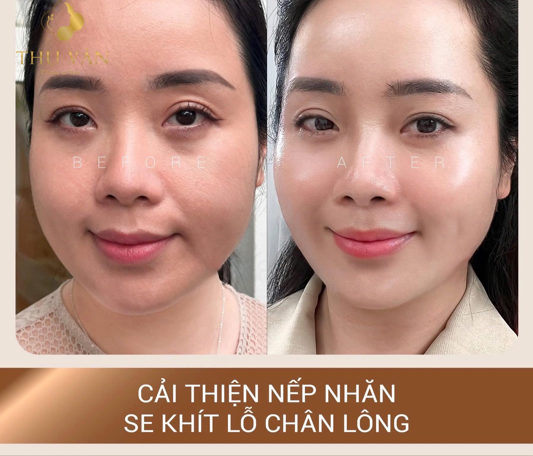 Viện Thẩm Mỹ Công Nghệ Cao Thu Vân ảnh 1