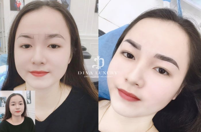 Viện Thẩm Mỹ DIVA - Sóc Trăng ảnh 2