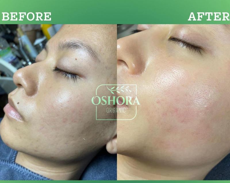 Oshora Organic Clinic & Spa ảnh 2