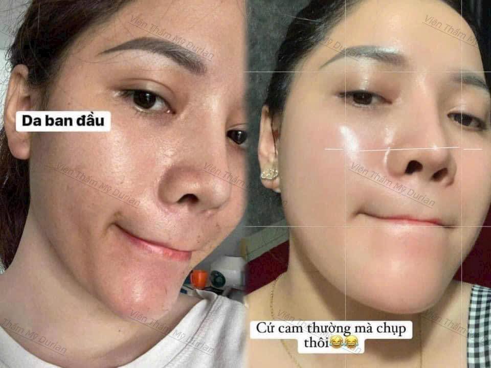 Viện Thẩm Mỹ Durian TP Gia Nghĩa ảnh 2