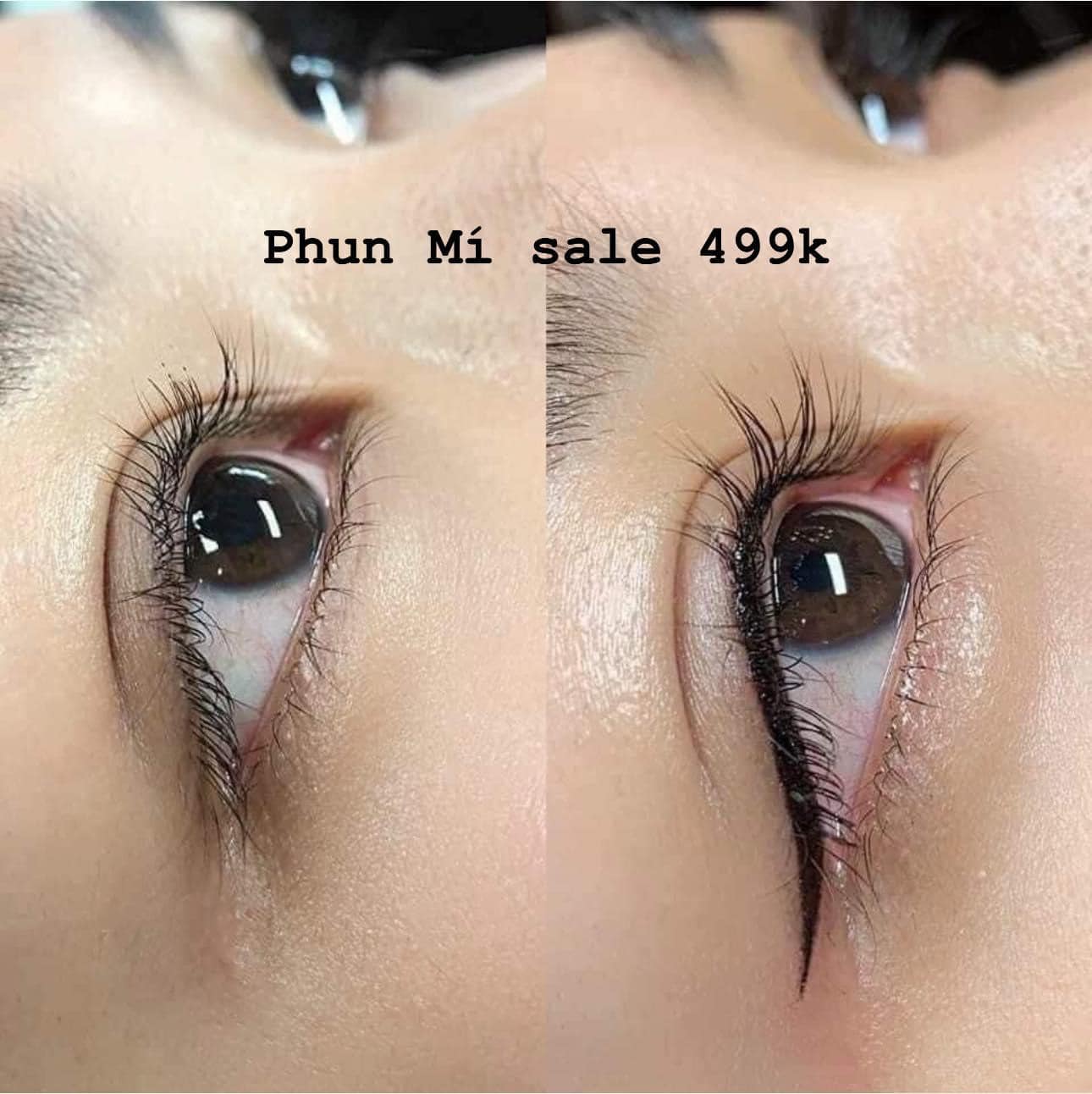 Viện Thẩm Mỹ Hoa Linh Beauty ảnh 1