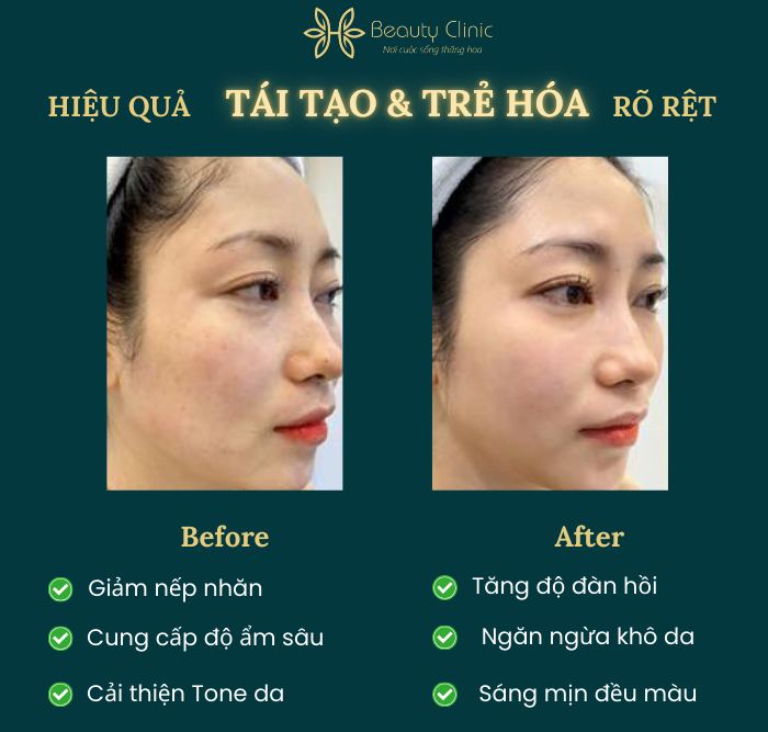 Viện Thẩm mỹ H Beauty Clinic ảnh 1