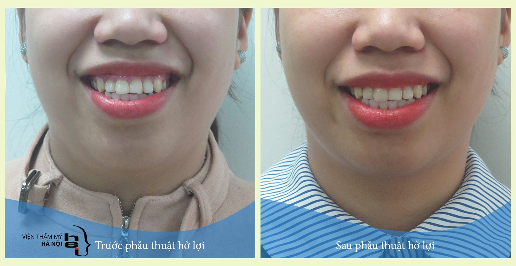 Viện thẩm mỹ Hà Nội ảnh 2