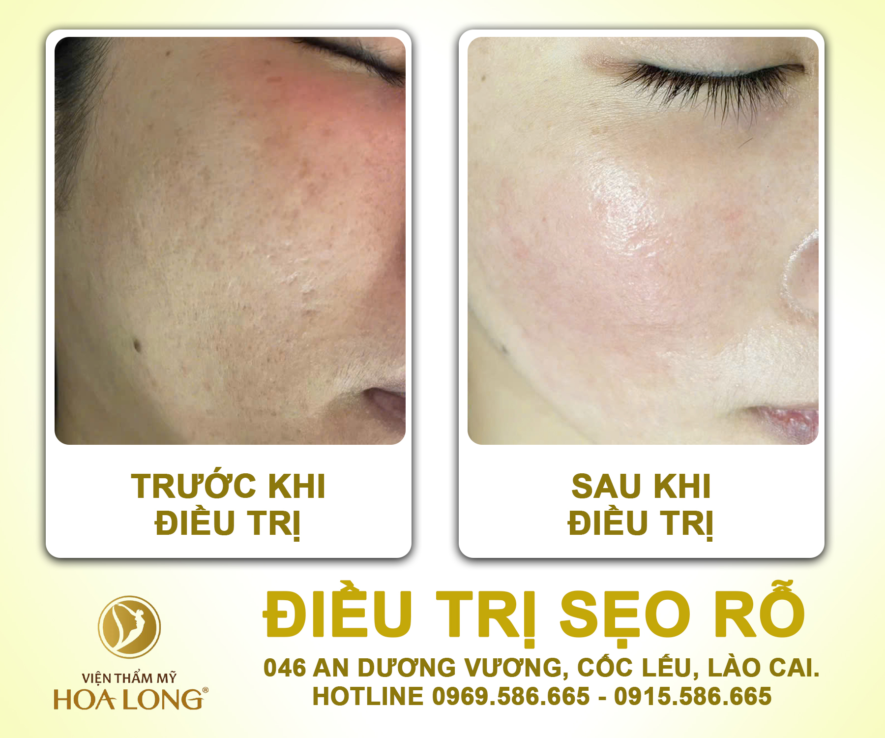 Hoa Long Spa ảnh 2