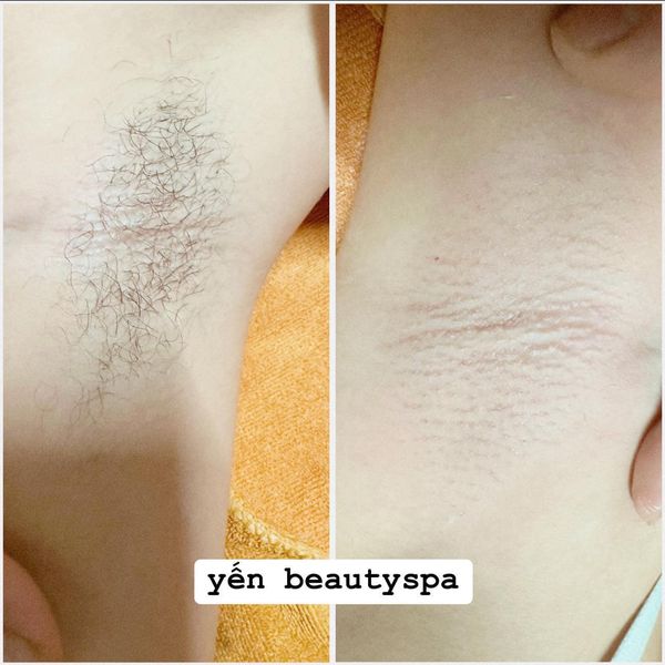 Yến Beauty Spa ảnh 2