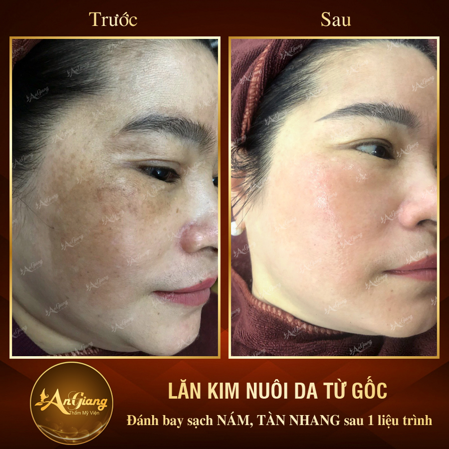 An Giang Beauty & Spa ảnh 1