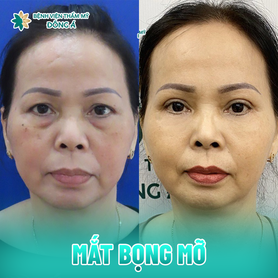 Bệnh Viện Thẩm Mỹ Đông Á ảnh 1