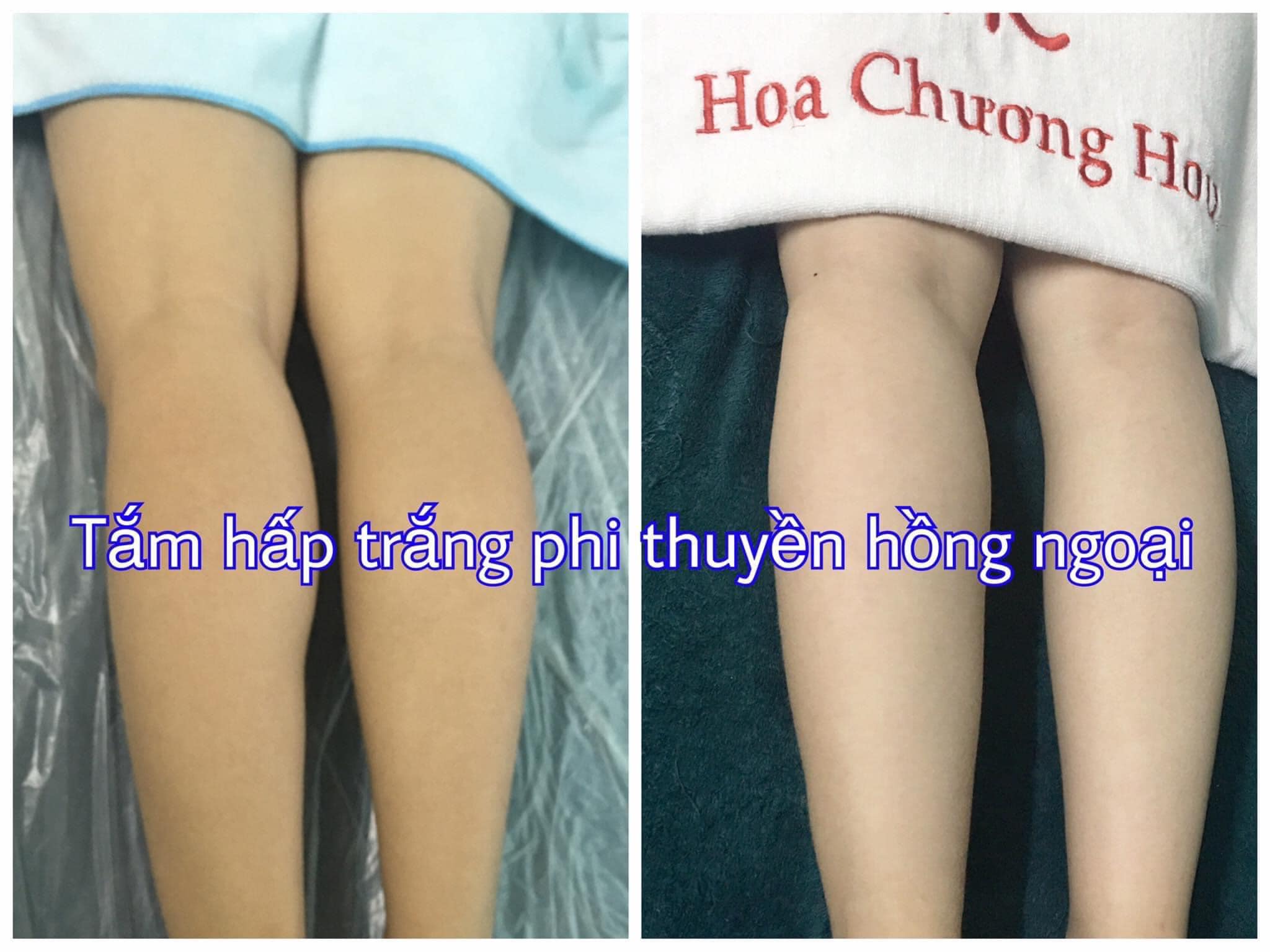 Hoa Chương Spa ảnh 1